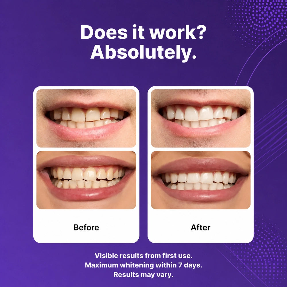 Purple Whitening Strips